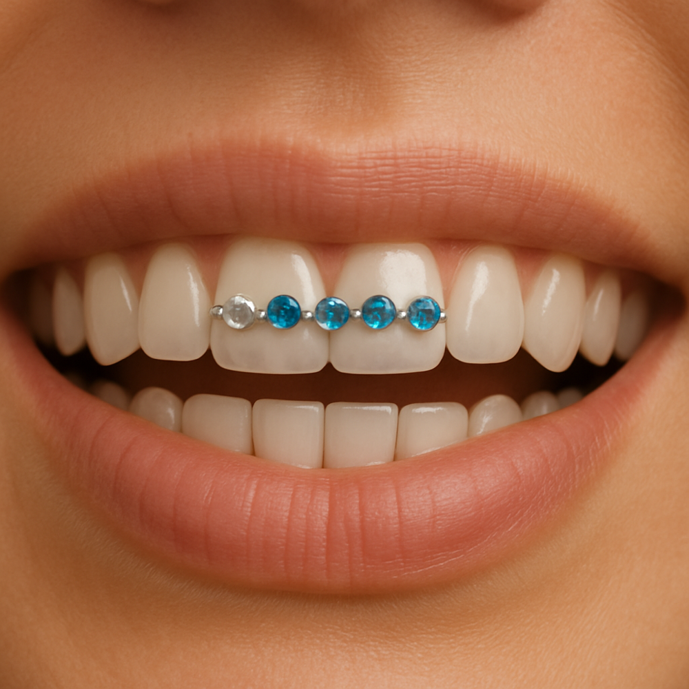2 TEETH BRACE BAR