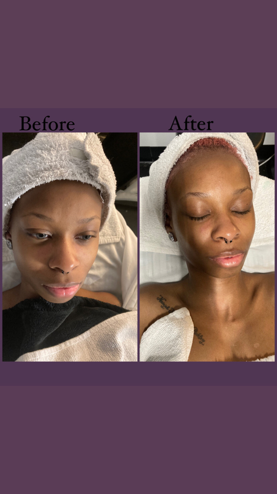 Basic Facial 1 HR