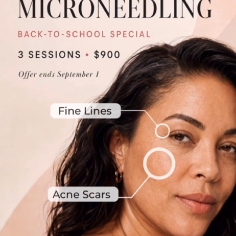 Microneedling Special at Jubee Boutique MedSpa in Annapolis, MD