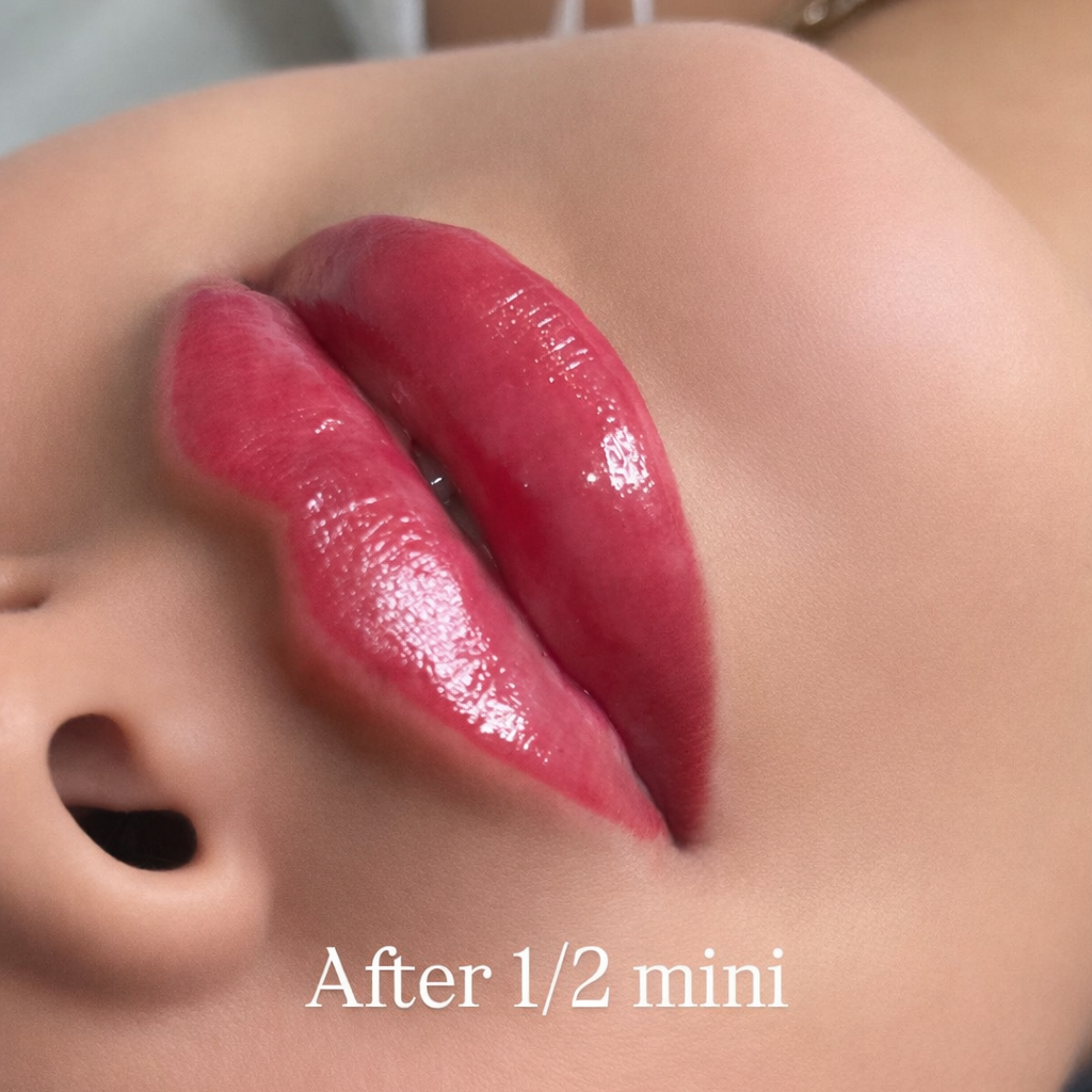 Filler 1/2ML Mini at Gold Stone Beauty in mcallen, TX