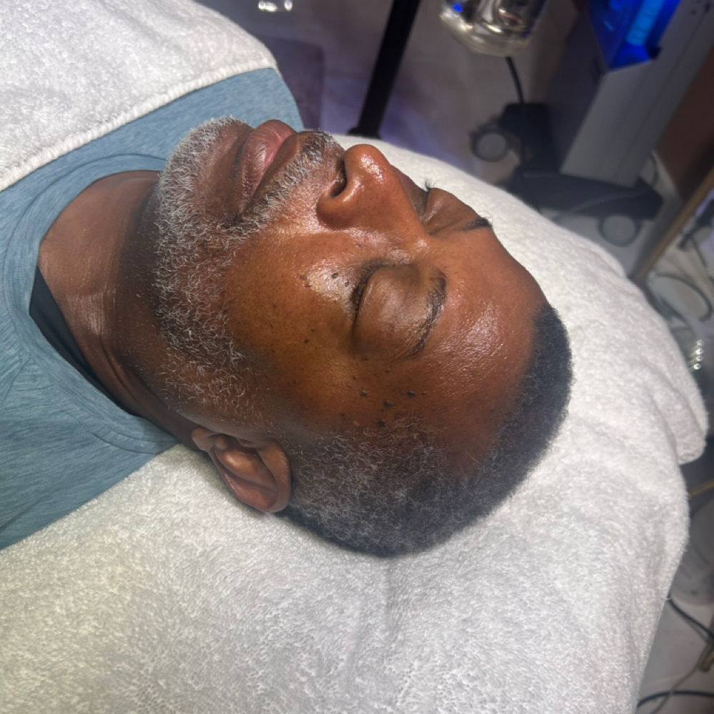 Men Microchanneling at Beauty Therapy by Chanel in Tucker, GA
