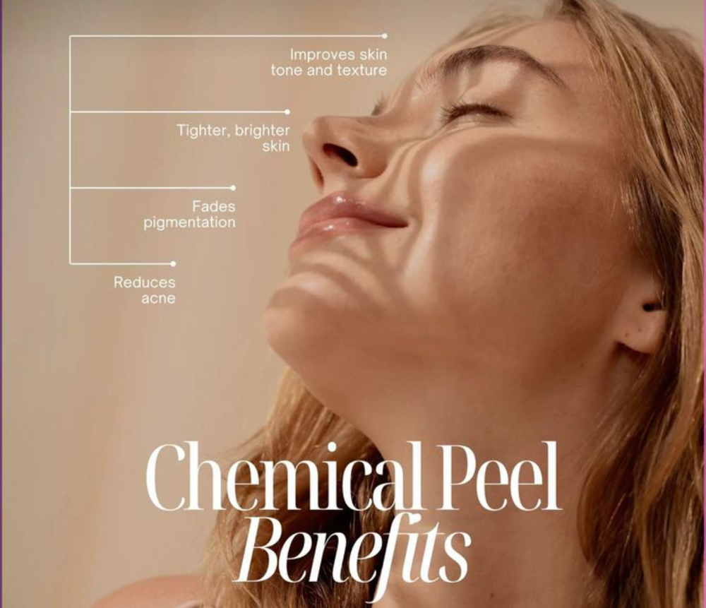 Custom Chemical Peel
