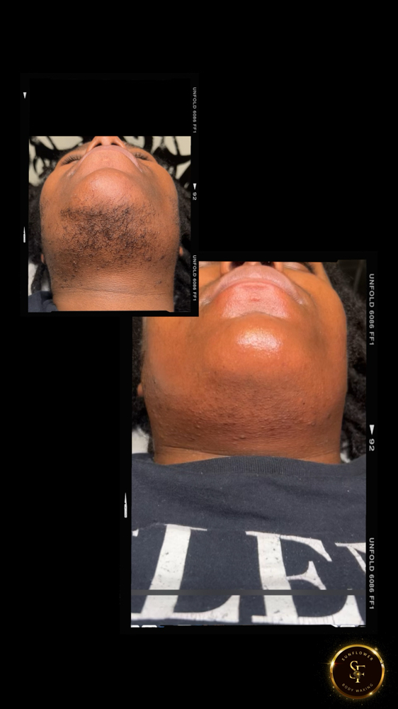 Chin Wax