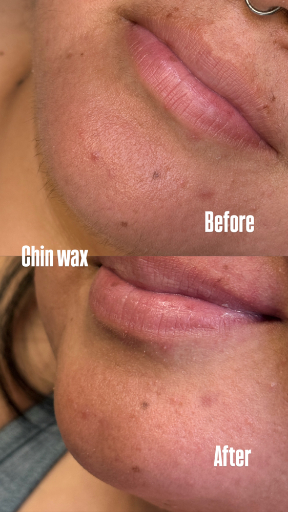 Chin Wax