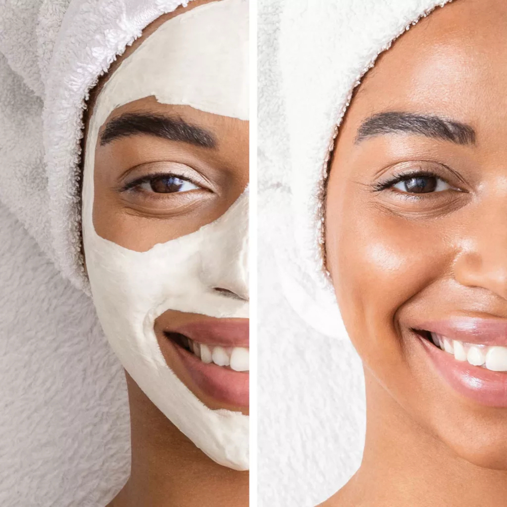 Initial Custom Facial W/ Consult at Refined Esthetics Co. in Chicago, IL