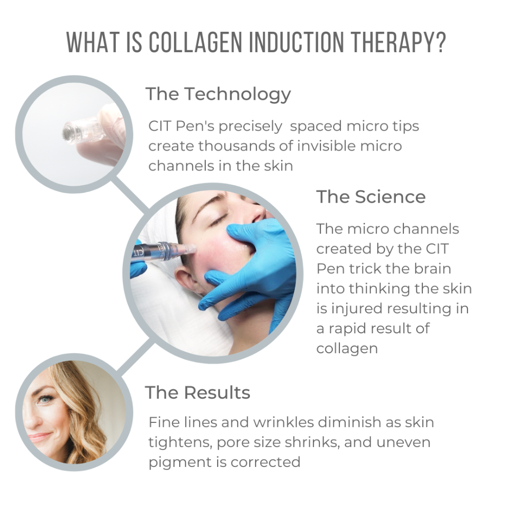 Microneedling Chest