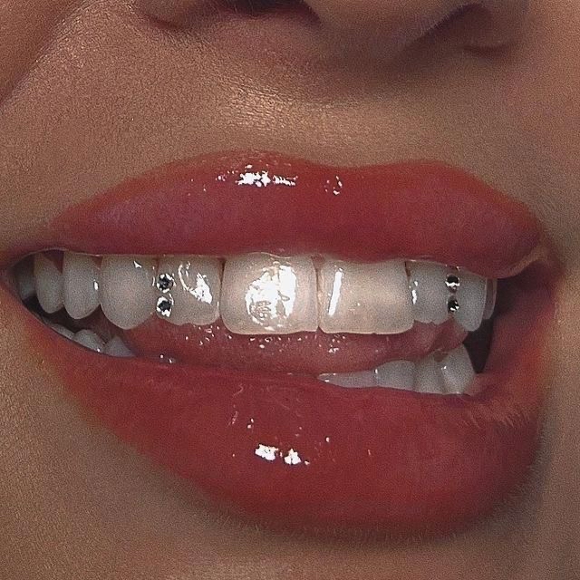 Tooth gems