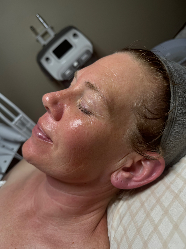 Customized Facial