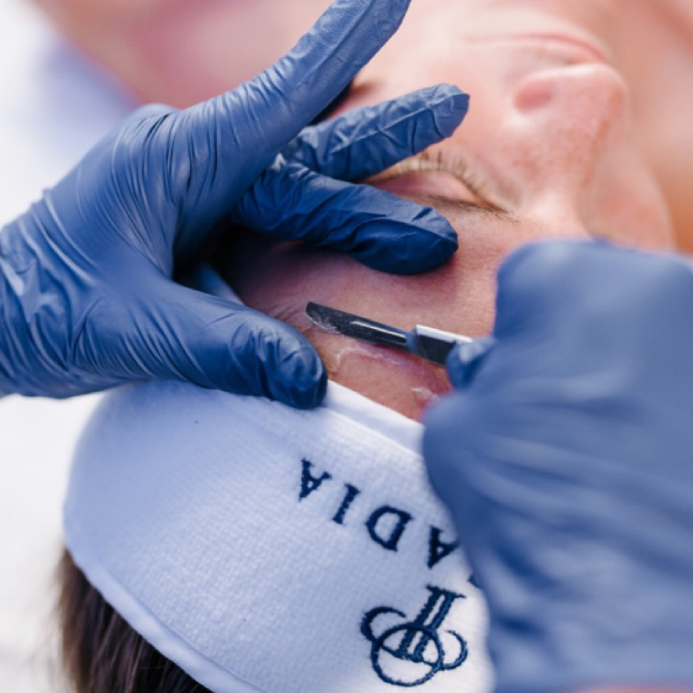 Express Dermaplane Facial