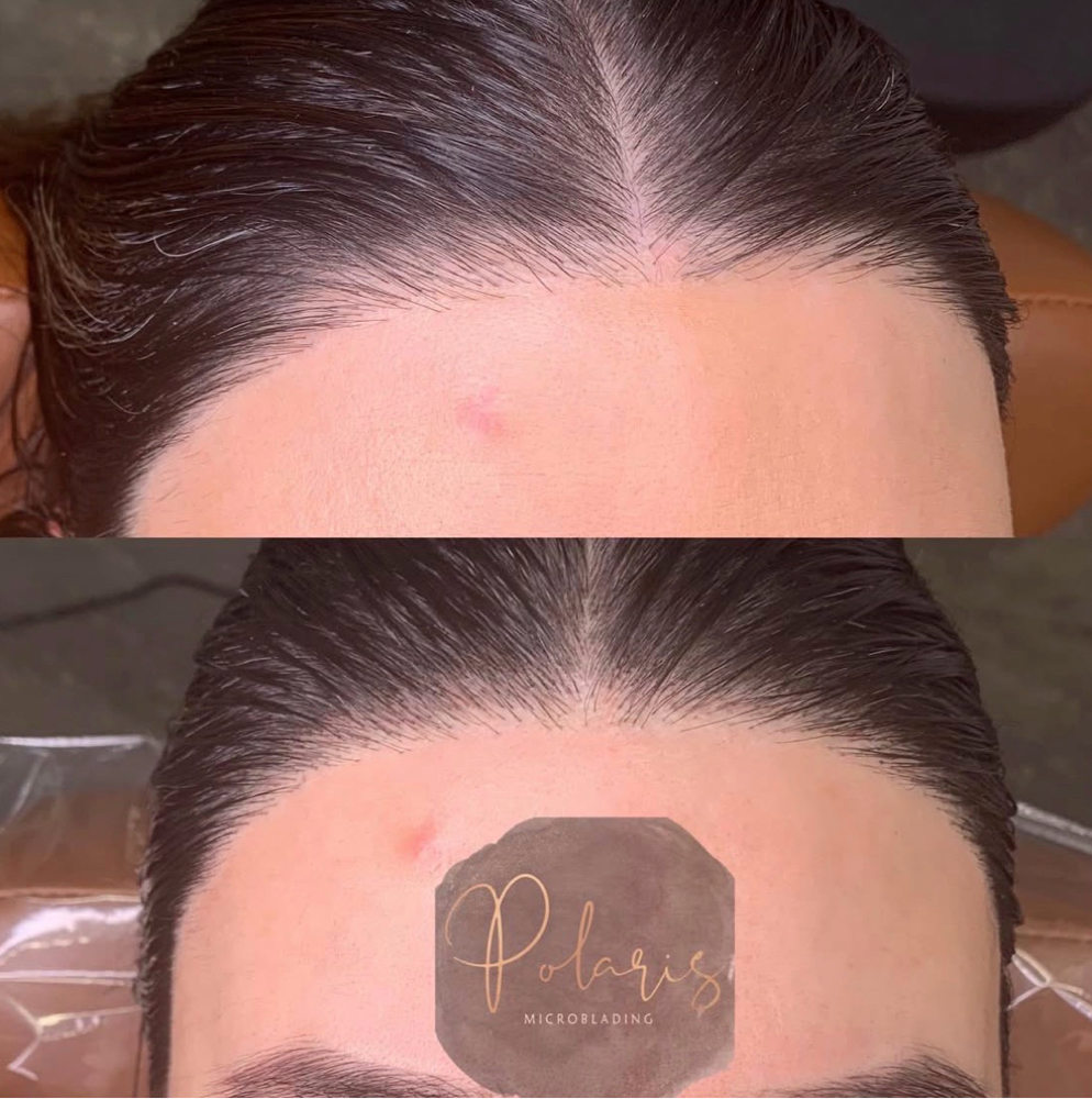 Hairline Microblade at Polaris Microblading in Dublin, OH