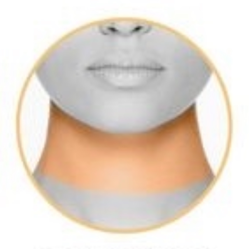 FRONT OF NECK Laser Hair Removal