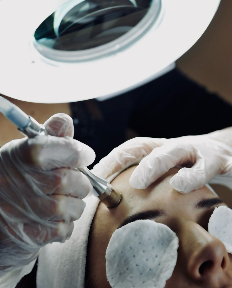 ADD ON ONLY - Microdermabrasion