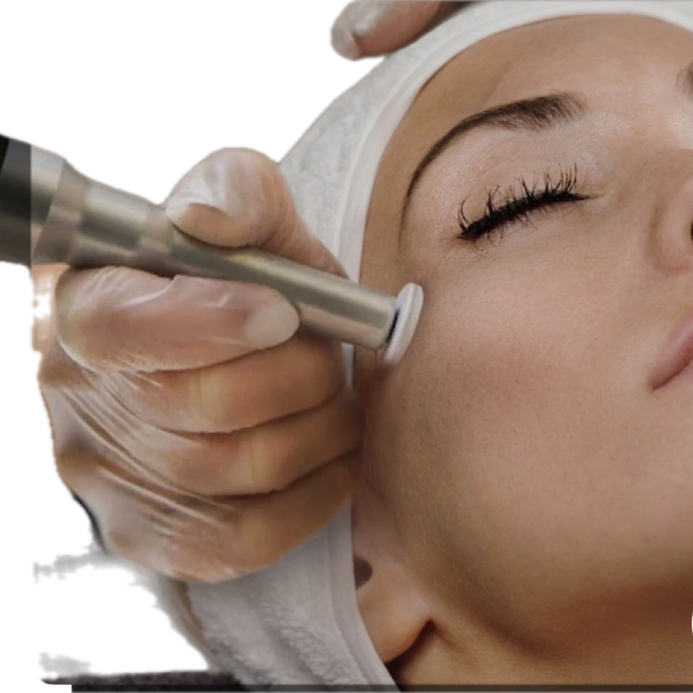 Microchanneling at Bella Shell Spa in Spring Branch, TX