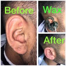 Ear Wax