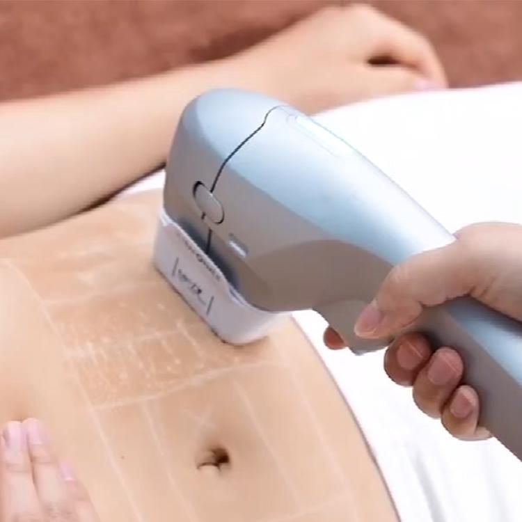 HIFU Abdomen- One Session