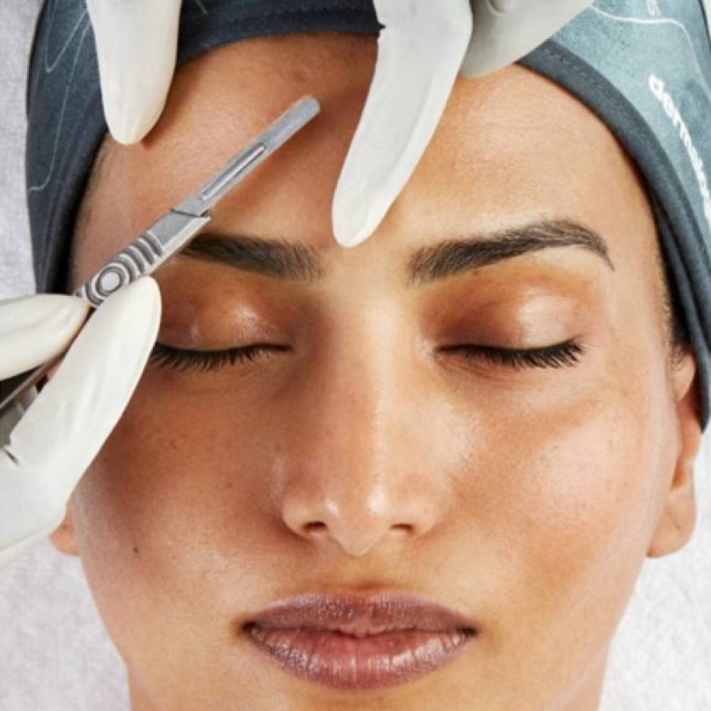 60 min dermaplane at progressive image salon in pataskala, OH