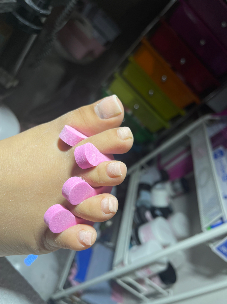 Fill (Toes)