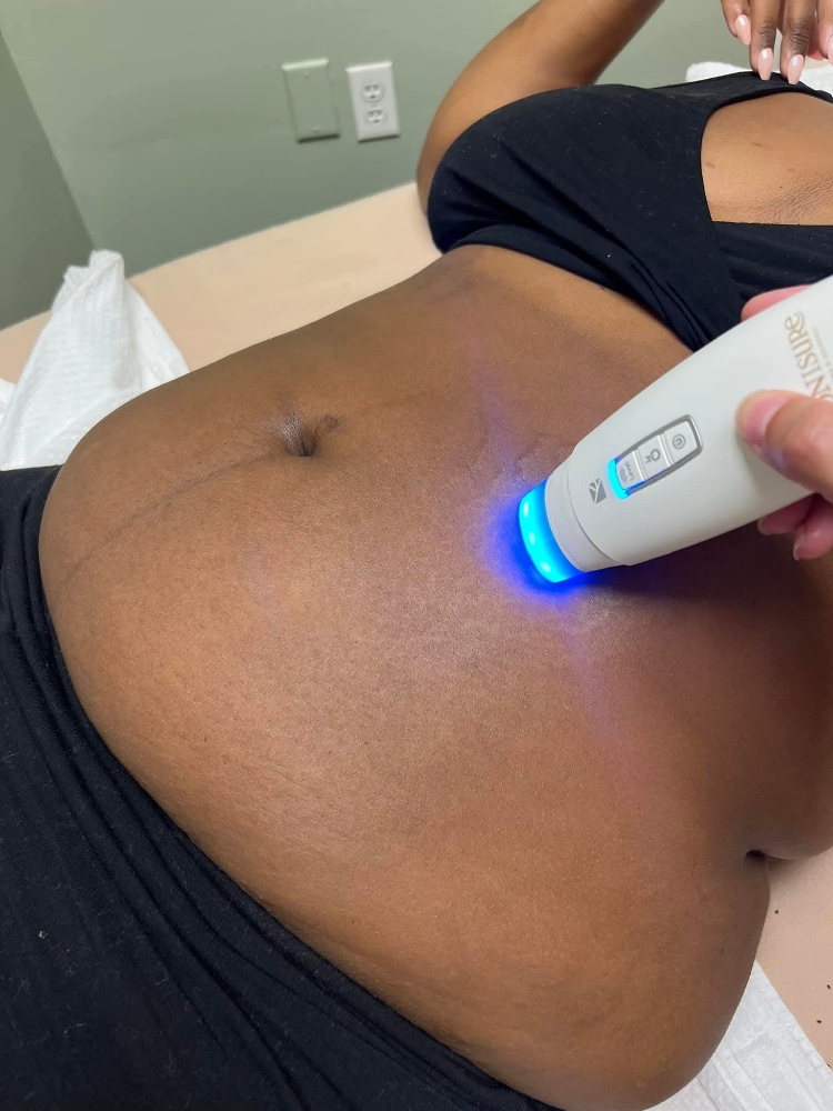 Tonisure Modality Add On