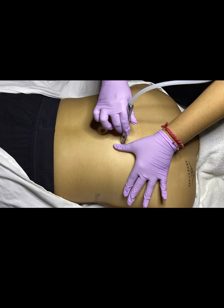 Back Glow + High Freq. Or Microderm
