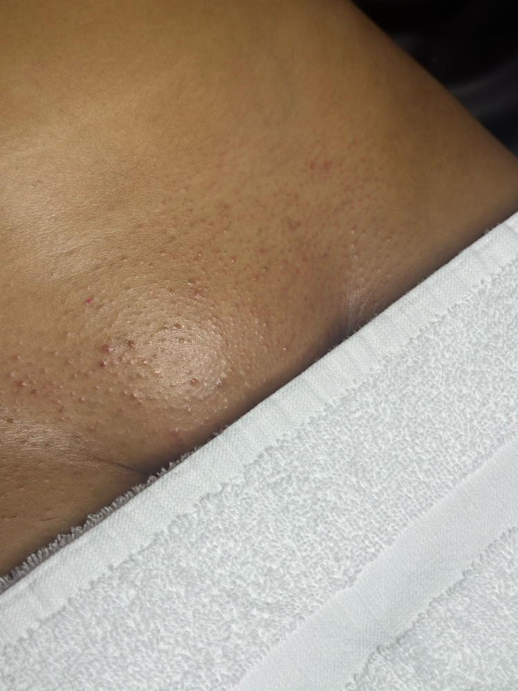 New Client Brazilian Wax
