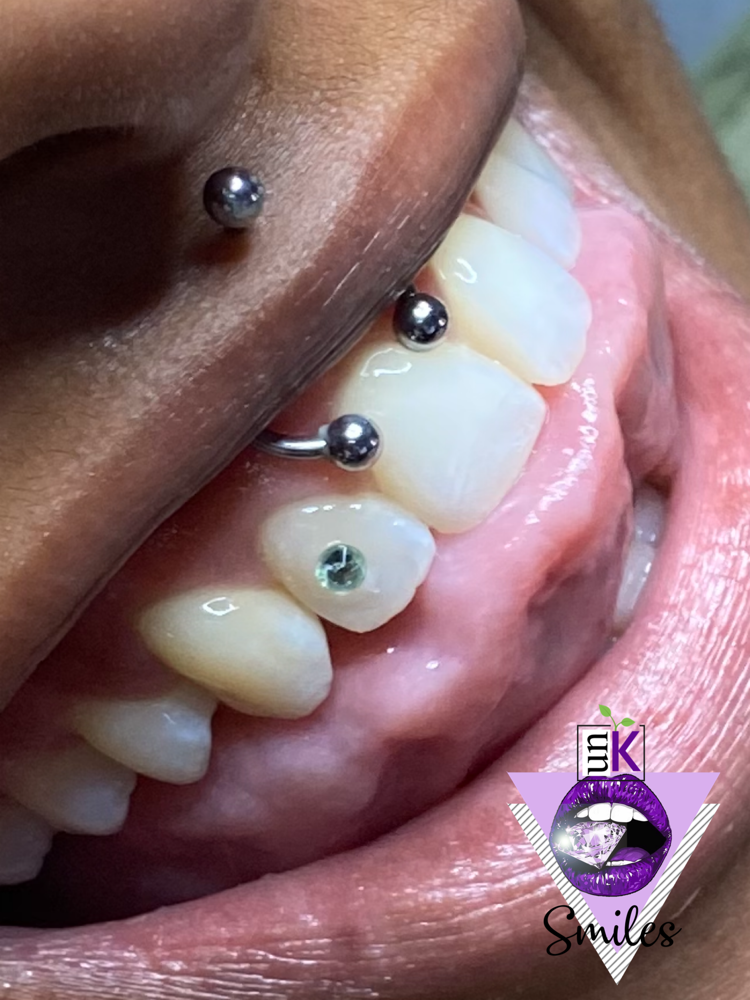 1 Swarovski Tooth Gem