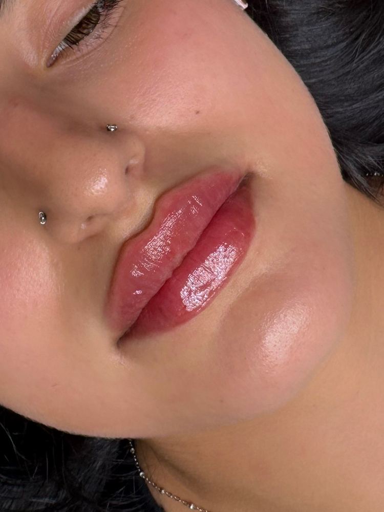 Dermal Lip Fillers at Al’Aura Aesthetics in Denver, CO
