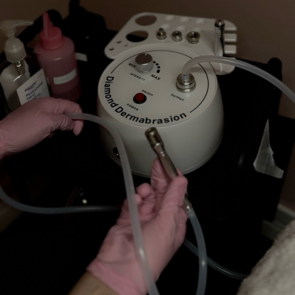 Microdermabrasion Facial at House of Esthetics LLC in Casa Grande, AZ
