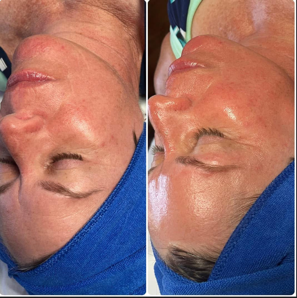 Express Glow Facial