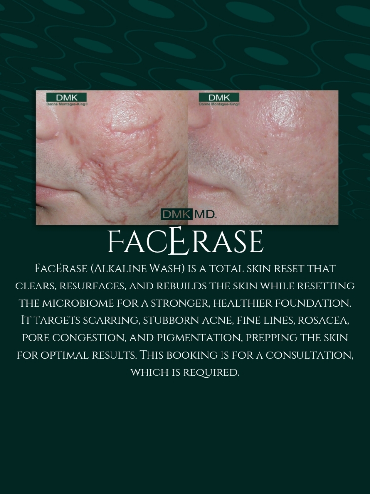 FacErase Consultation