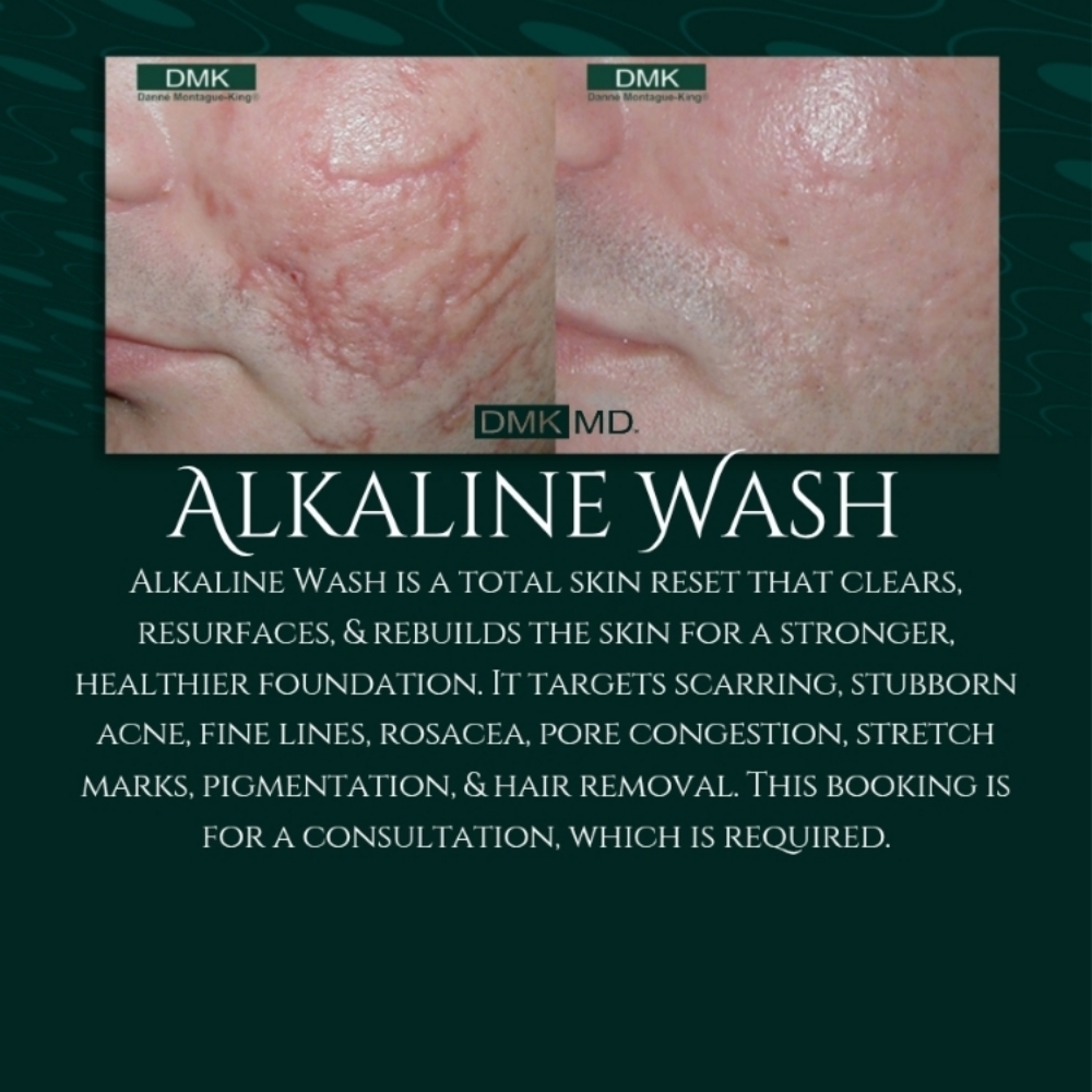 Alkaline Wash Consultation