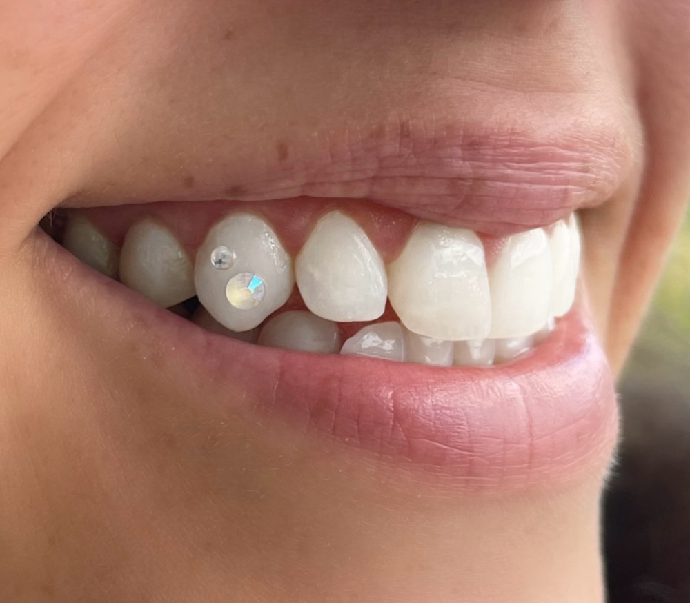 2 Swarovski Crystal Tooth Gems