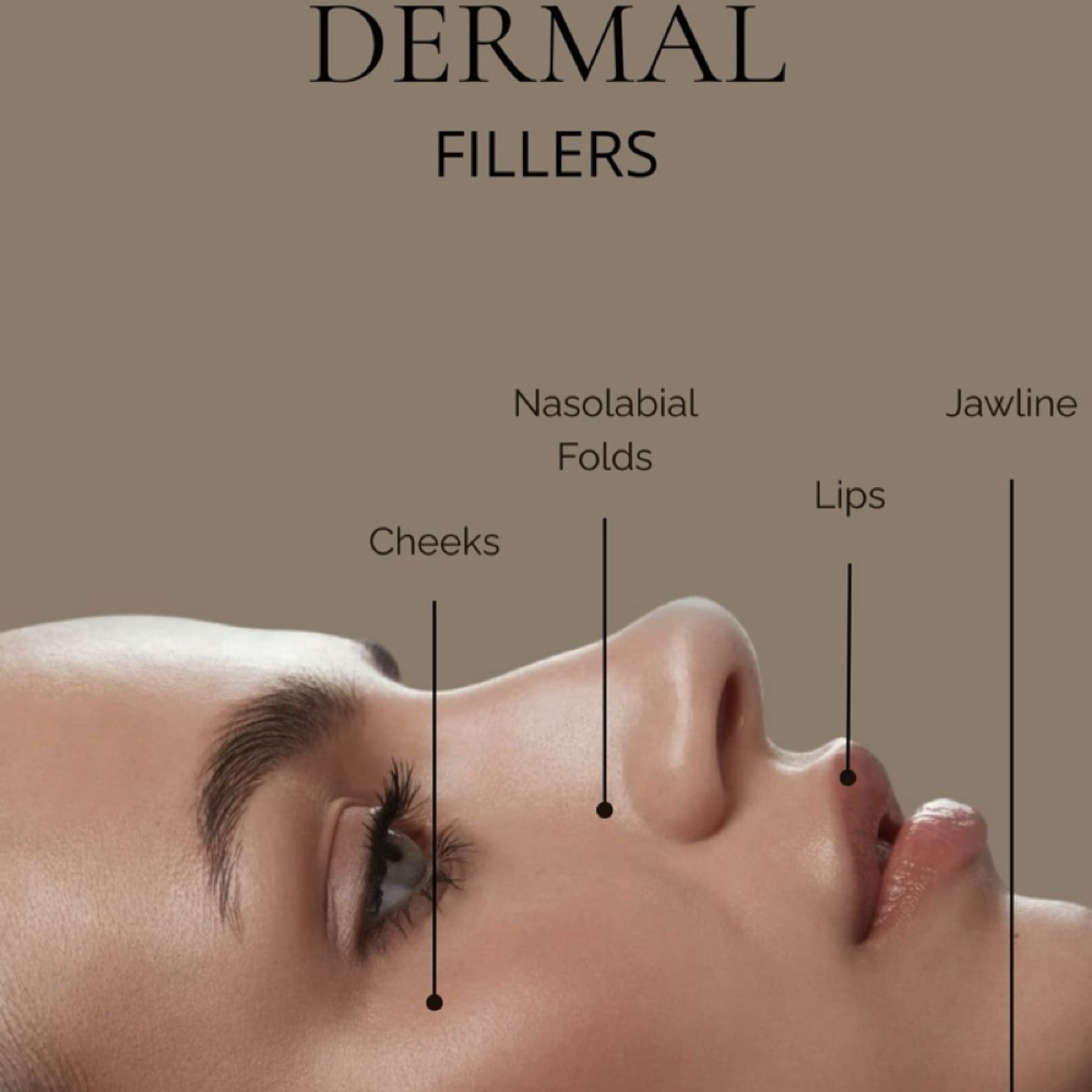 Facial Balancing – 3 ML at Inject Me Beautiful in Abilene, TX