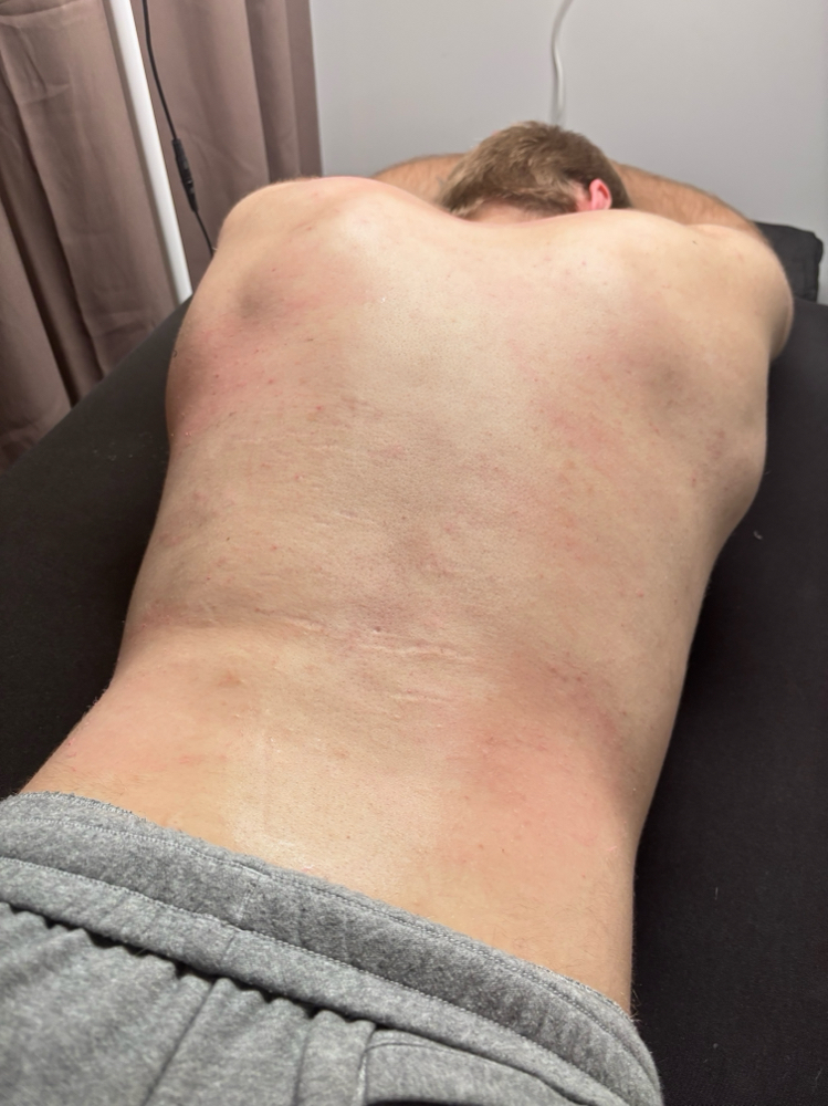 Back Wax
