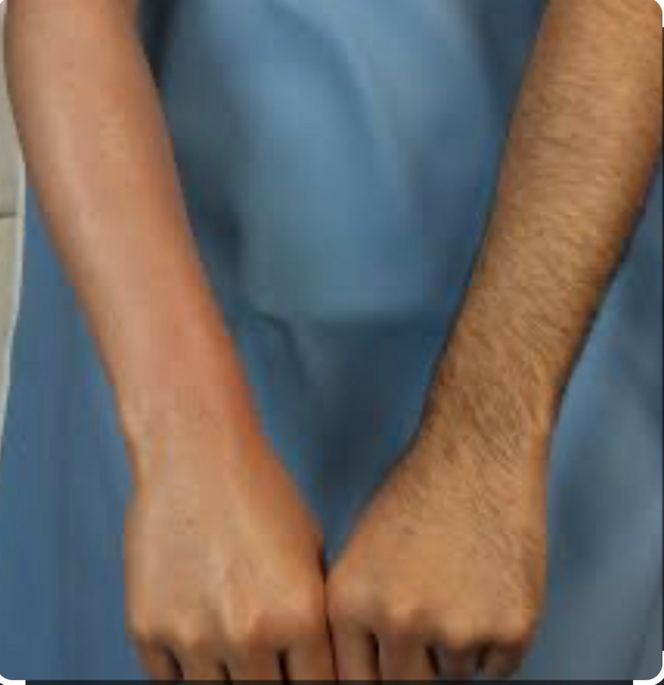 Male Full Arms Waxing