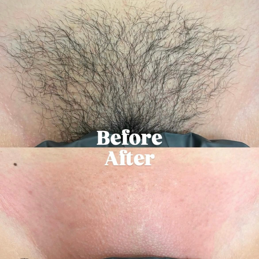 Brazilian Wax/Sugar at The Beauty Effectt LLC in Tucson, AZ