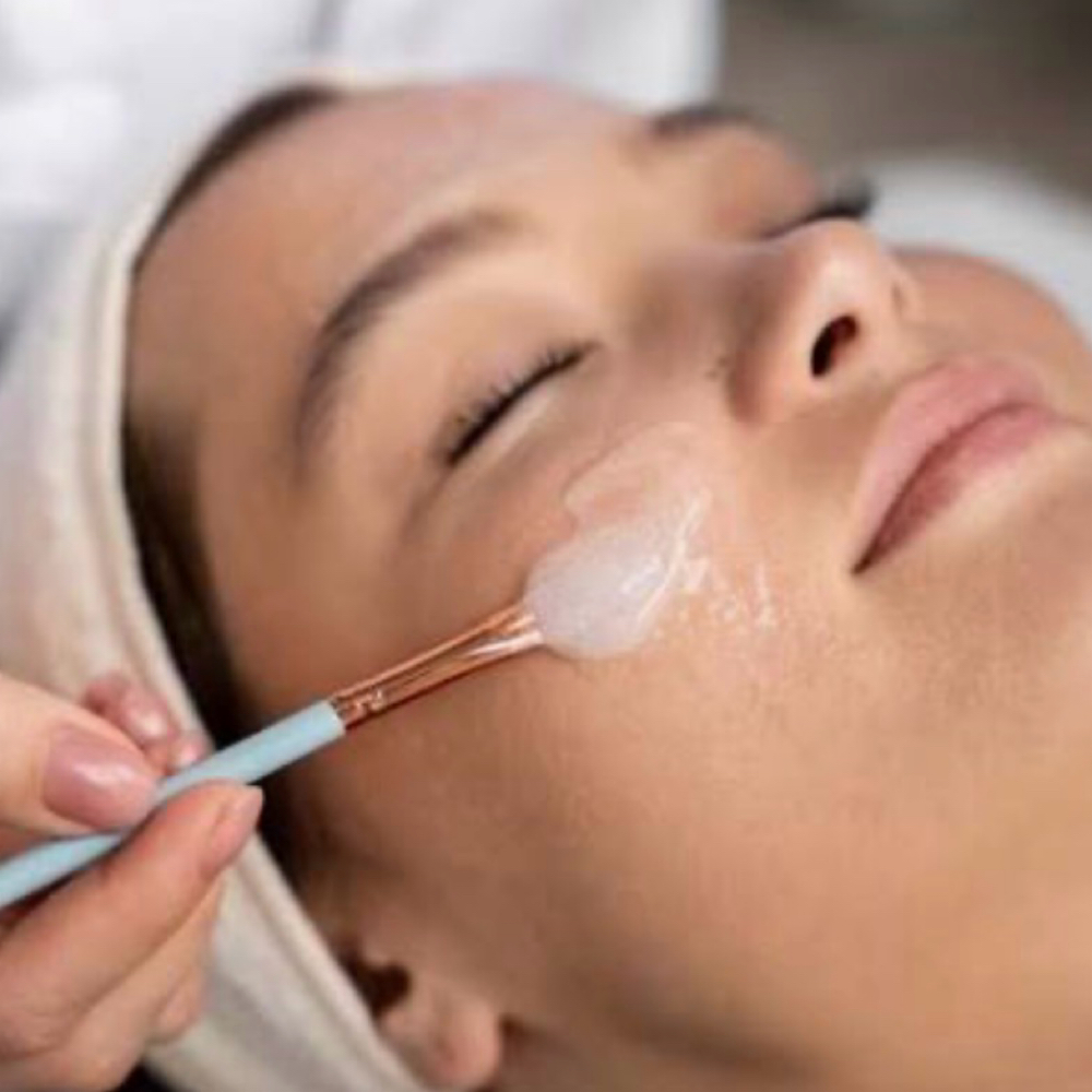 Glycolic Peel at Face to Face with Angela in Trinity, FL