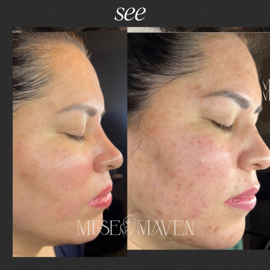 Fully Curated Facial at MUSE MAVEN SKINTIQUE AND WELLNESS in Atlanta, GA