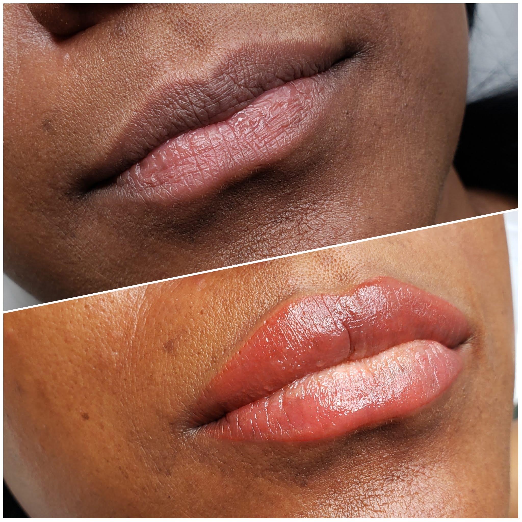 Dark Lip Neutralization