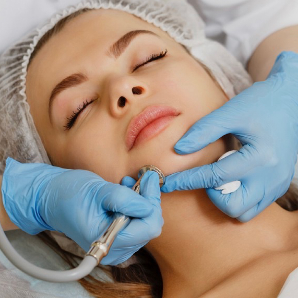Microdermabrasion at Shea Beauty Bar in Pineville, LA