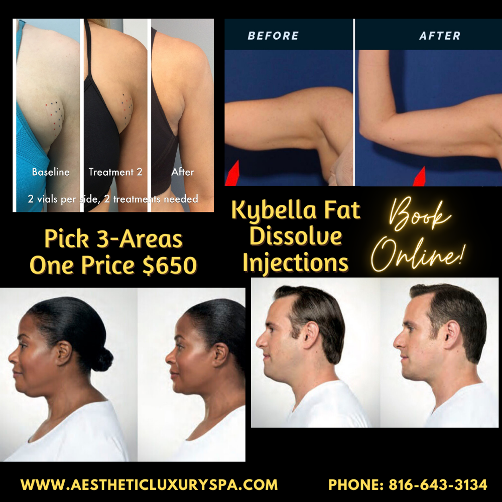 Kybella Injections (Bra Area)