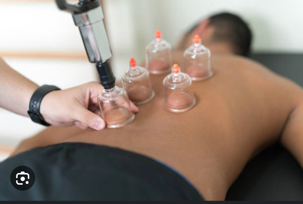 30min Cupping Therapy