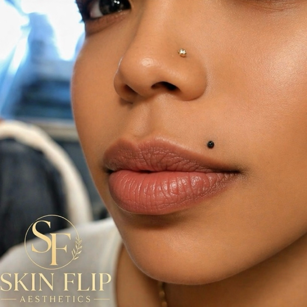 Beauty Mole at Skin Flip Aesthetics by Nurse O in Woodlawn, MD