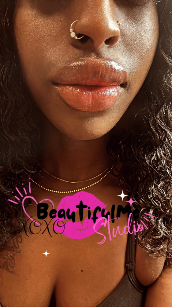 1.5 Lip Enhancement