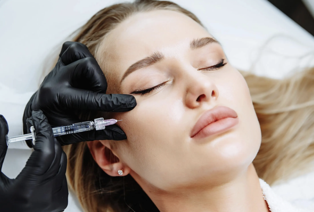 Dermal Filler Cheeks