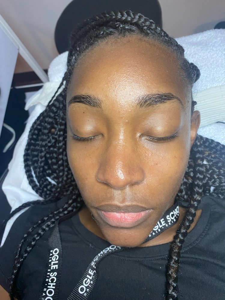 High Frequency Facial
