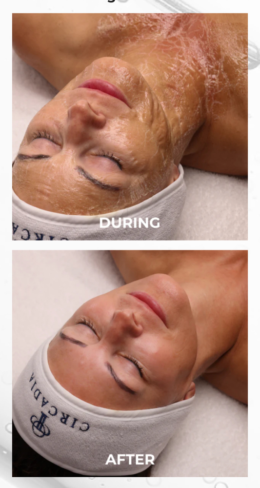 Beach Luxelift Facial