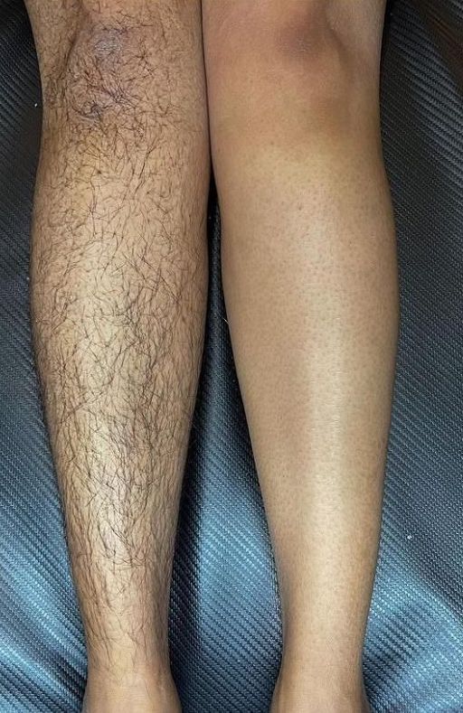 Lower Leg Wax