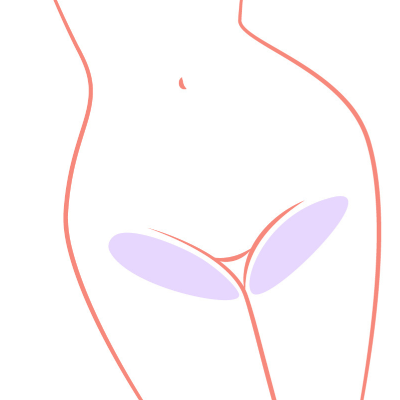 Bikini Line (Ladies)