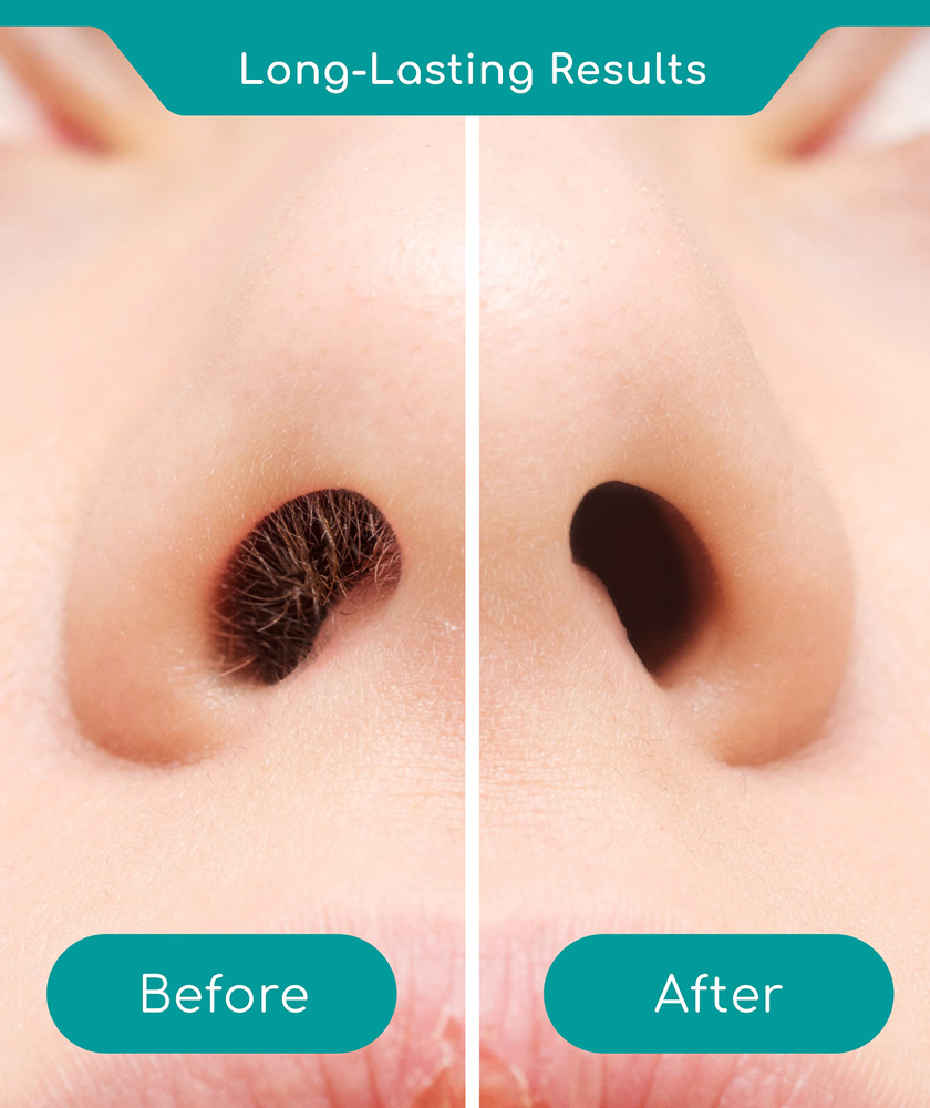 Nose Hair Waxing