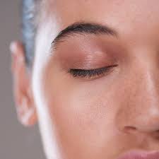 PRP Undereye at Savy Aesthetics in San Antonio, TX